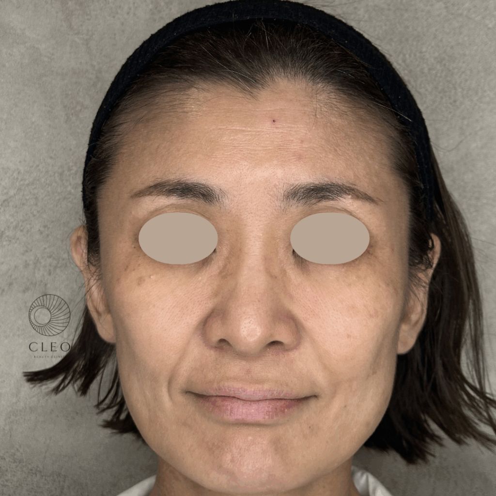 Cleo Beauty Clinicの写真